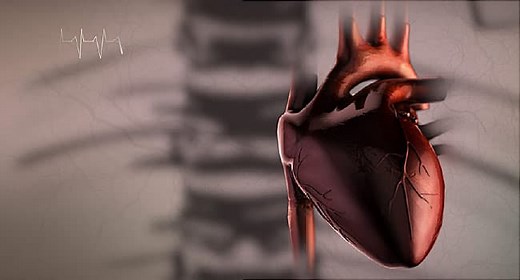 Inside a Heart Attack