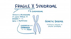 Video: Fragile X syndrome - Video Explanation! | Osmosis | Osmosis