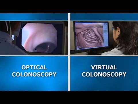 Colonoscopy screening: Virtual vs. optical colonoscopy