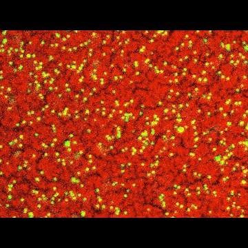 Nanoparticles Assembling at the Interface