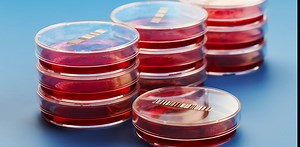 Lab-grown meat techniques aren’t new – cell cultures are common tools in science, but bringing them up to scale to meet society’s demand for meat will require further development