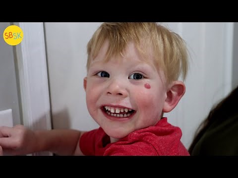 A Kid with a Gene Mutation (Fragile X)