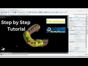 Designing a 3D printable Dentium Implant Surgical guide for Anterior teeth in Blue Sky Plan Part 1