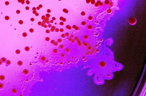 Types of Biotechnology