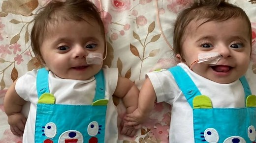 My twins' bones are so fragile they're like egg shells and a hug can break them