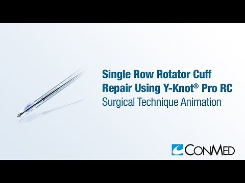 Single Row Rotator Cuff Repair Using Y-Knot® PRO RC - CONMED Animation
