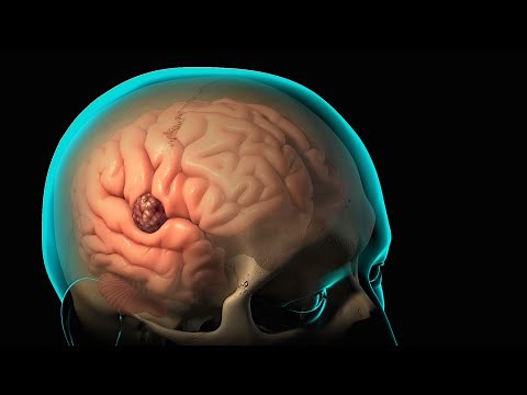 Craniotomy and Craniectomy