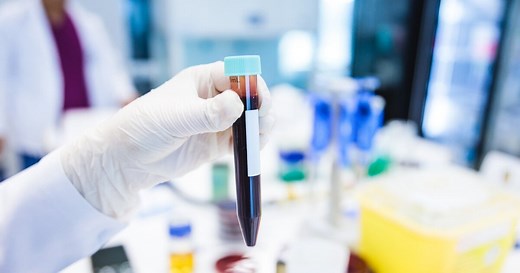 GFR-Wert mit Tabelle: Wann ist der Wert im Blut zu niedrig?