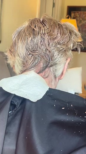 What a severe lice infestation looks like #explore #hair #Piojos #momlife #lice | Stacey The Louse Lady