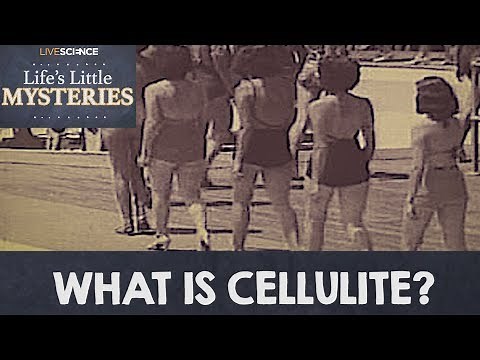 What is Cellulite?