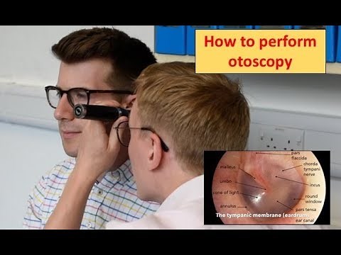 How to perform Otoscopy (Ear Exam)