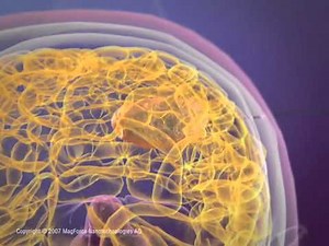 fighting cancer with magnetic nanoparticles.flv