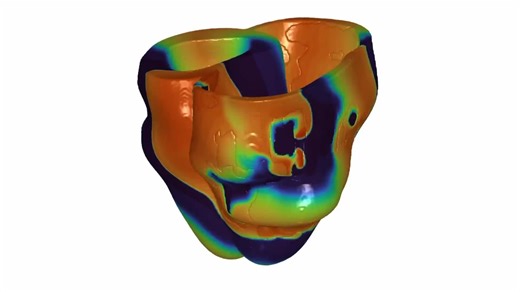 A ‘Digital Twin’ of Your Heart Lets Doctors Test Treatments Before Surgery