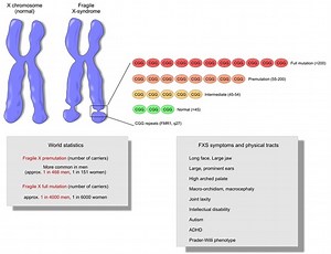 What is Fragile X Syndrome?