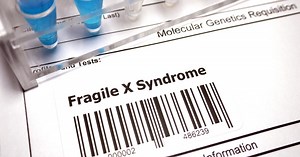 Breaking down Fragile X Syndrome