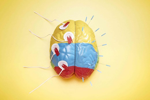 What Are the Different Parts of the Brain?