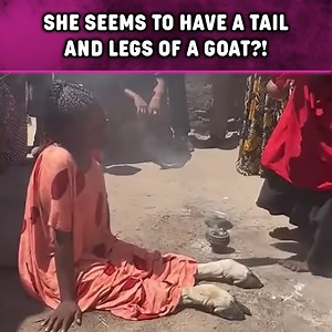 Woman With Goat Legs Caught In Camera In Tanzania | Slapped Ham