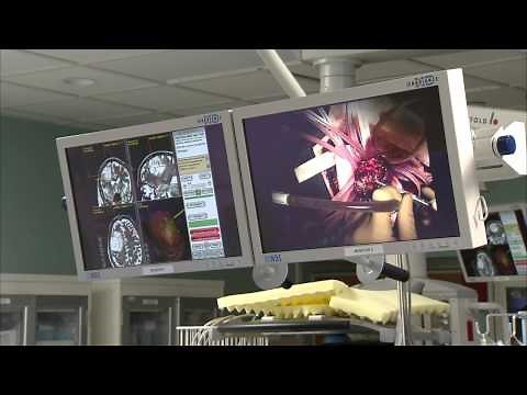 Awake Craniotomy at Barnes-Jewish Hospital